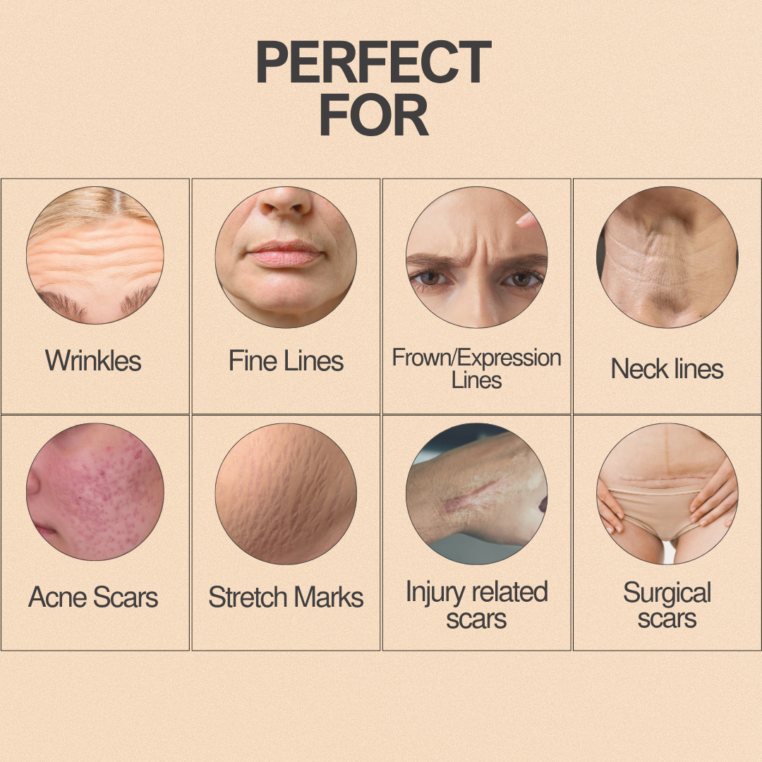 Zenora™ - Silicone Scar Sheets