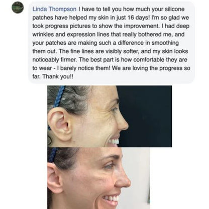 Zenora™ - Silicone Scar Sheets